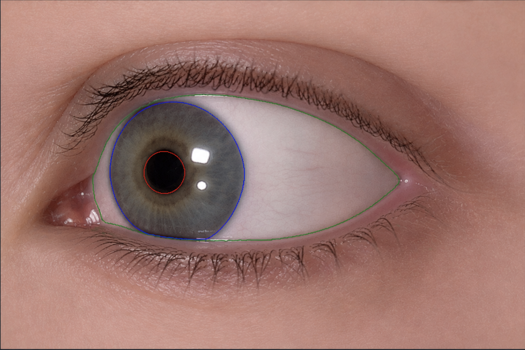 Solvemed annotation tool screenshot